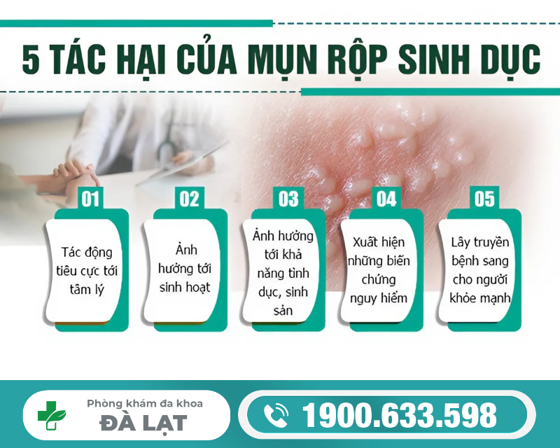Hình ảnh minh họa